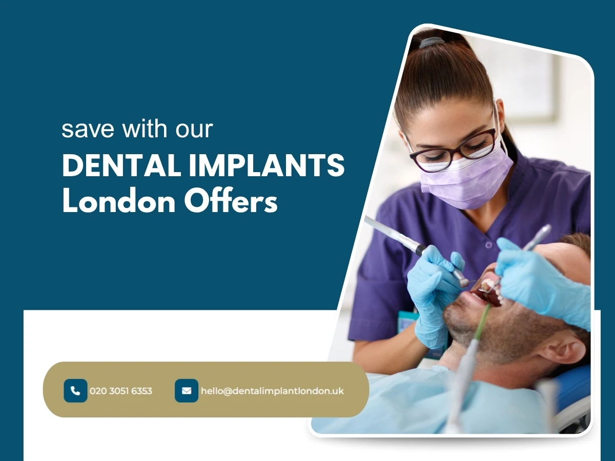 Dental Implant London cover image 1