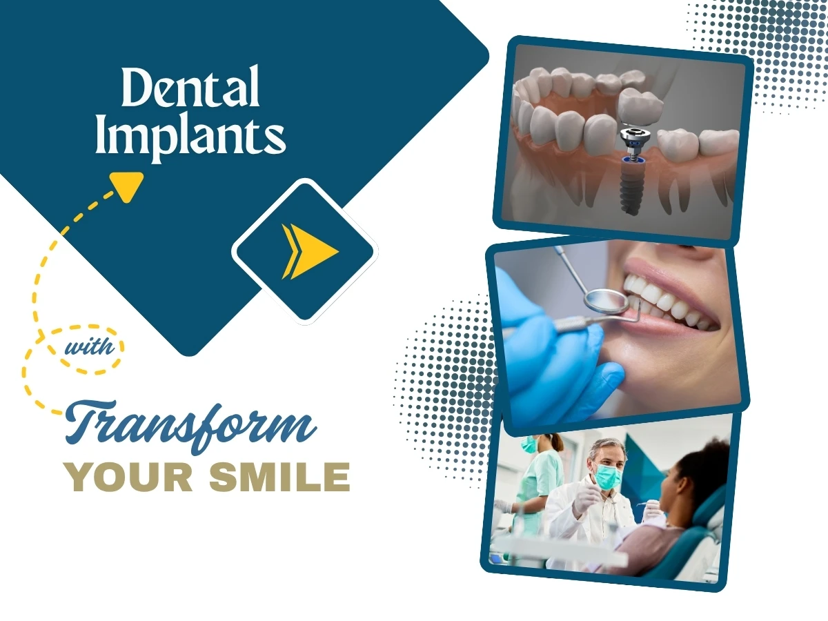 Dental Implant London cover image 2