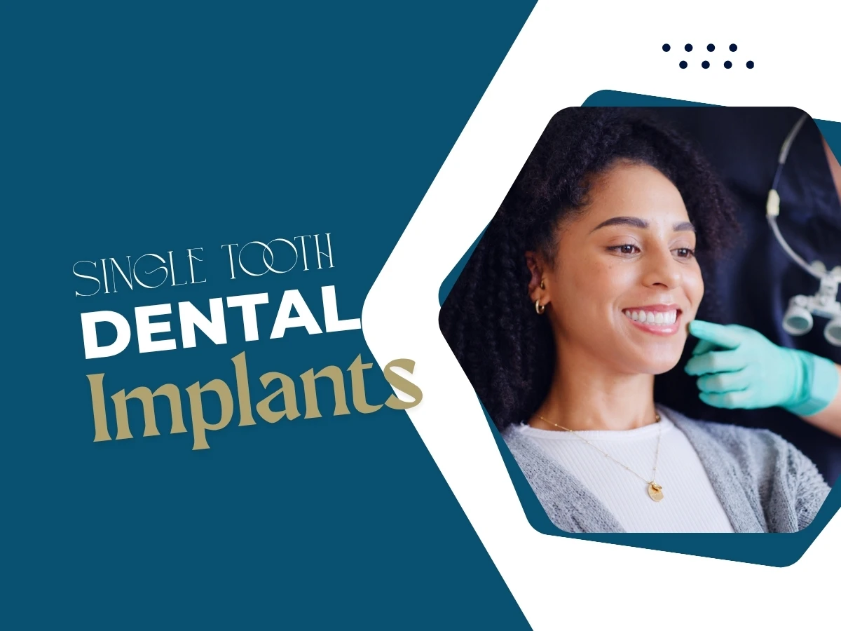 Dental Implant London cover image 3